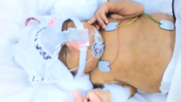 治療と戦う小さな体を守る。子どもが使えるボディーソープの開発