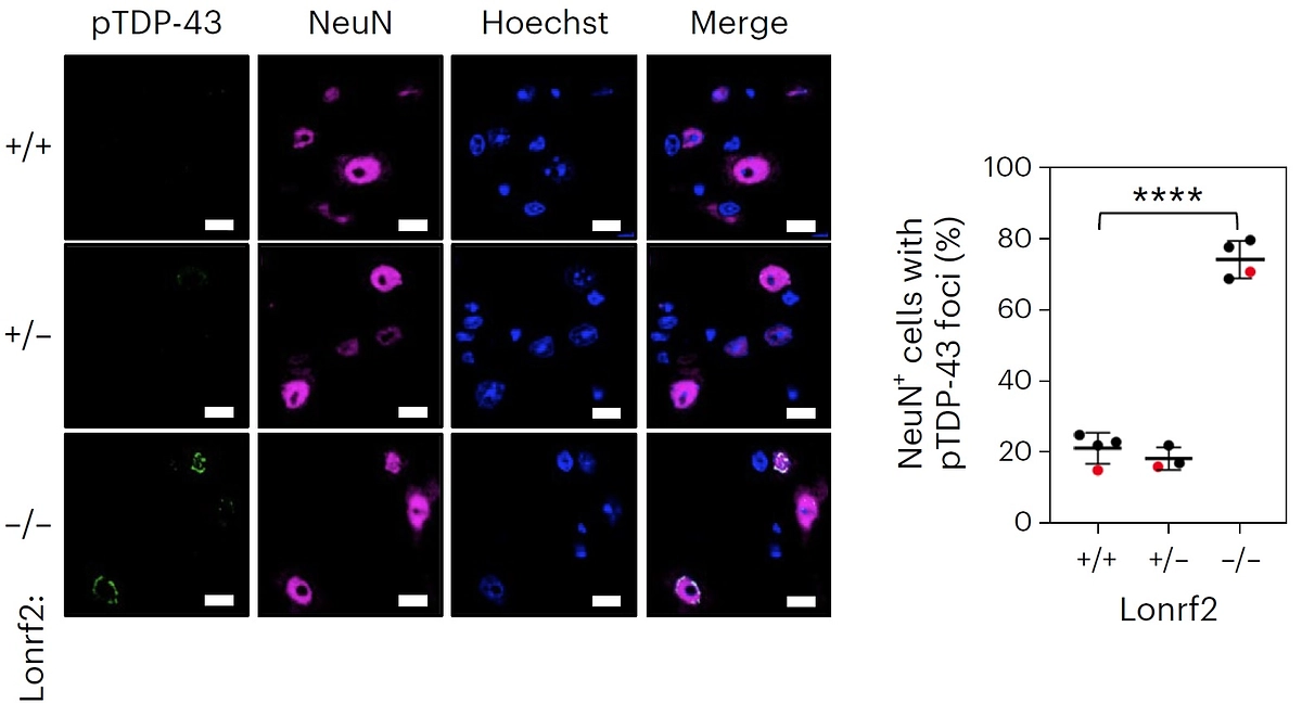 【研究成果報告】ALSの原因となる異常タンパク質の分解を誘導する酵素を同定 ―ALS治療への応用―