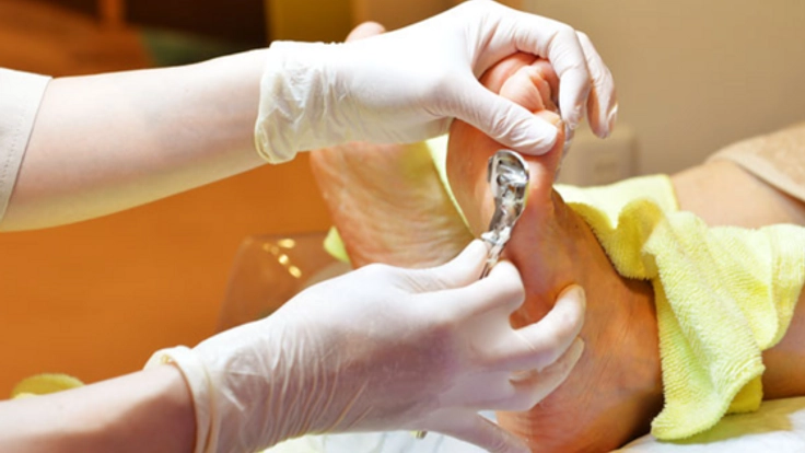 足・爪のトラブル解消！トータルフットケアサロンの開業！