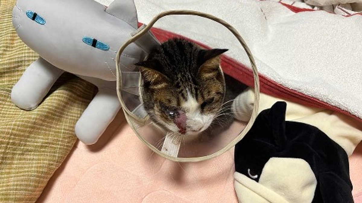 3回目の放射線治療