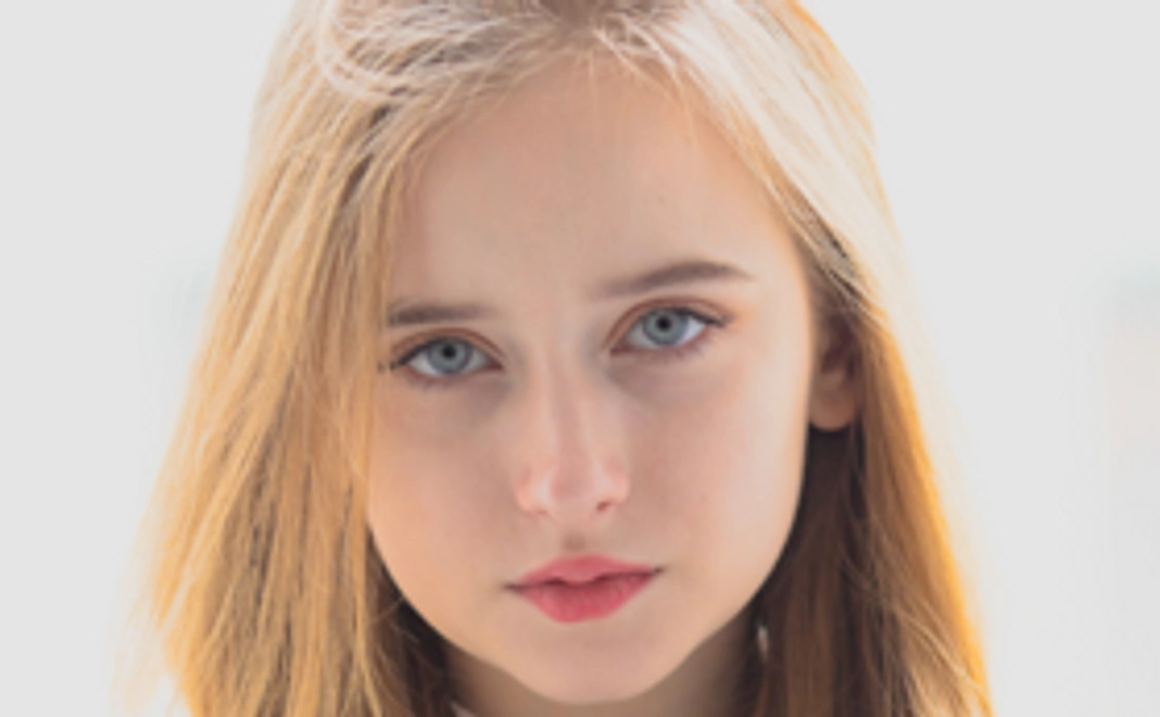 アドバンス支援