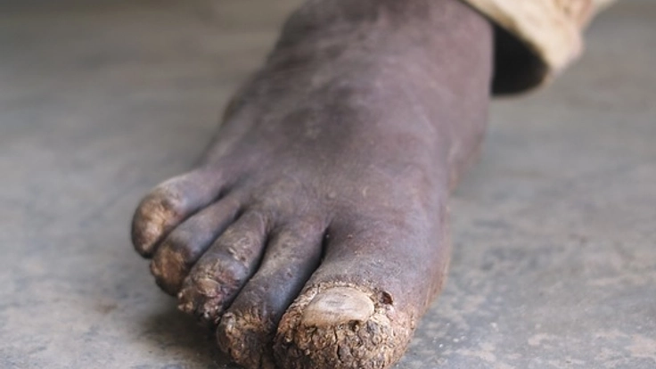 一生歩ける幸せを！ケニアの子どもにきれいな運動靴を届けたい！