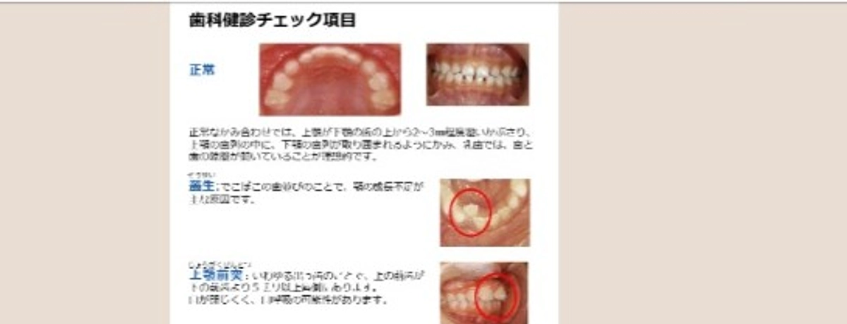 歯並び・噛み合わせに関する記事のご紹介