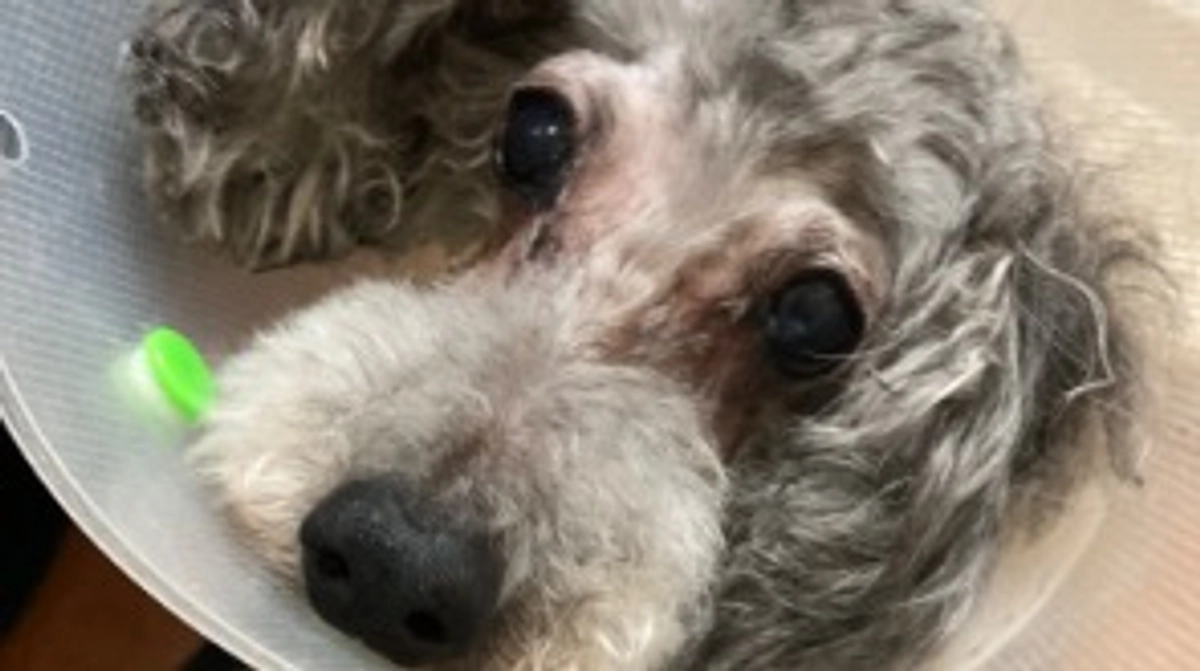 退院と術後診察について