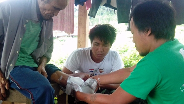 ミャンマー地雷被害者に初めての義足を。新しい一歩を共に！