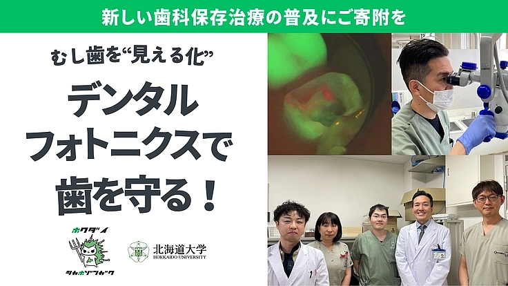 フォトニクスで歯を守る！「見える化」で細菌と戦う  新しい歯科保存
