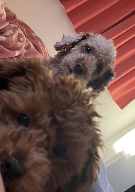 本日もう片足の手術をします