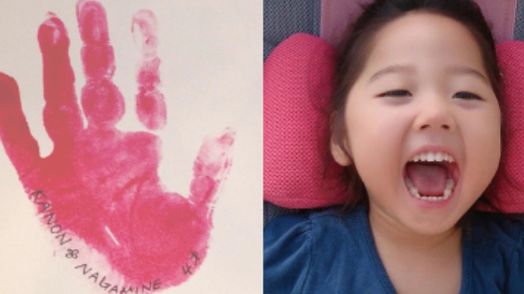 チャリティーライブを通じ障がいのある子ども達の手形を世界へ!