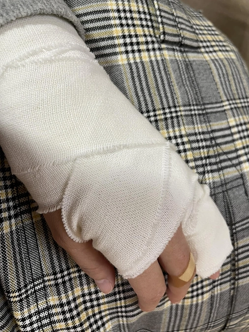 看護の人に感謝 骨折した手でクラウドファンディング