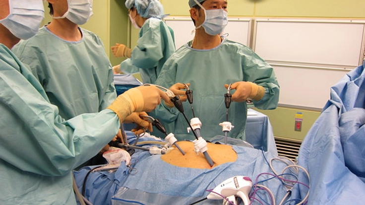 胃癌患者さんの術後障害の程度を適切に評価するためのアプリ制作