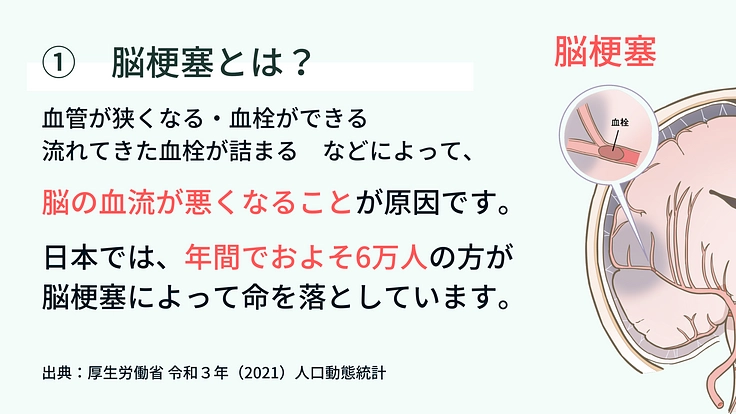 急性期脳梗塞に対する、新規血栓溶解薬導入への臨床試験継続へご支援を 2枚目