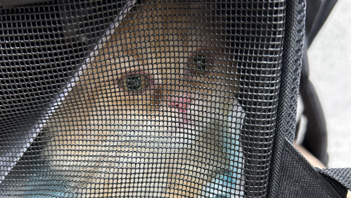 【経過観察14日目】