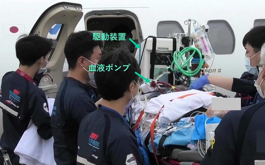 国内で開発された唯一の遠心ポンプVAD装着患者の世界初ジェット機搬送を5例目として実施しまし