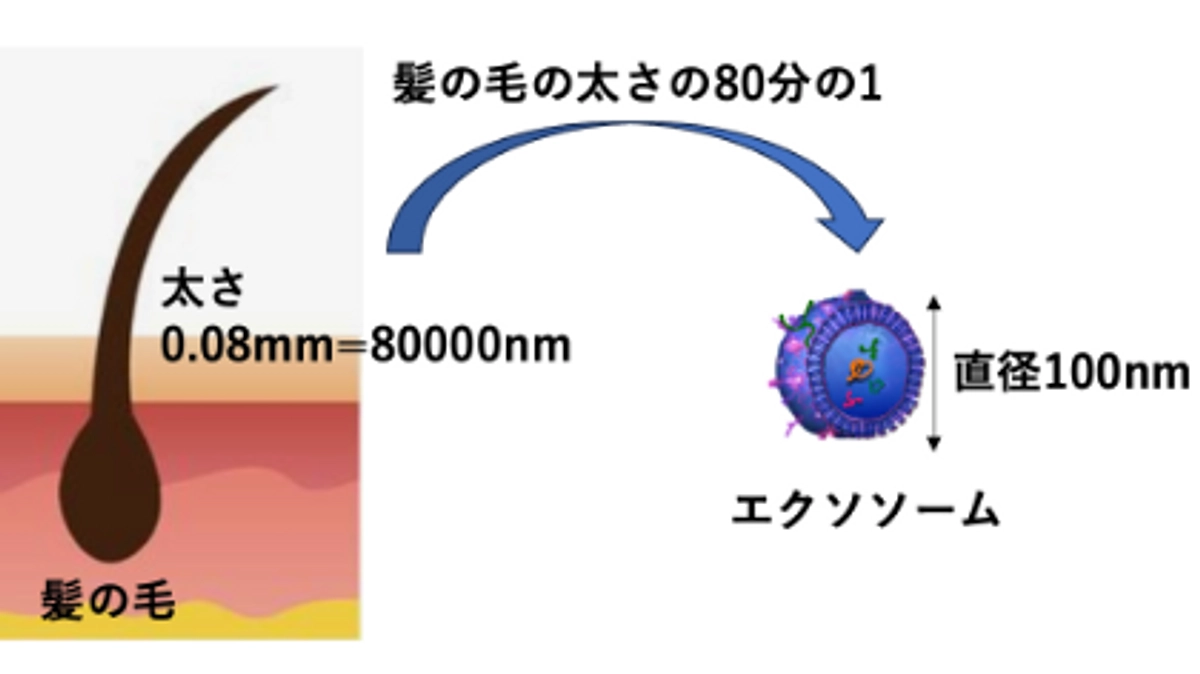 エクソソームの発見