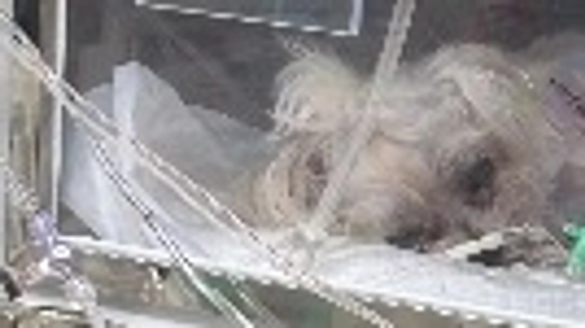 ㊗️手術結果について㊗️