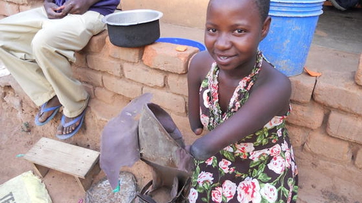 「悲しみ」という名の少女に義足を贈り、一緒に歩きたい