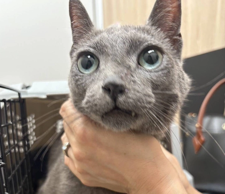 １回目の放射線治療が終わりました。