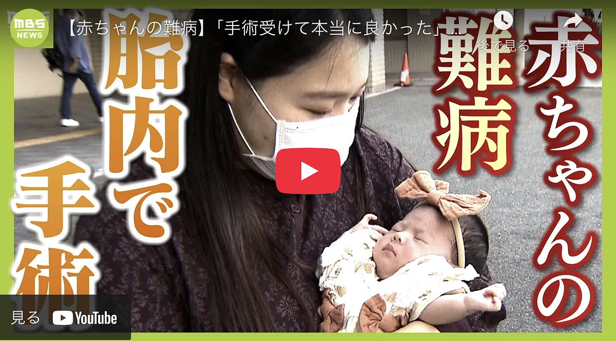 【記録】2024年10月16日【ＭＢＳニュース特集】で取り上げられた報道です。