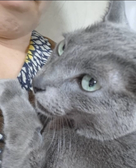 ３回目放射線治療を終えました。