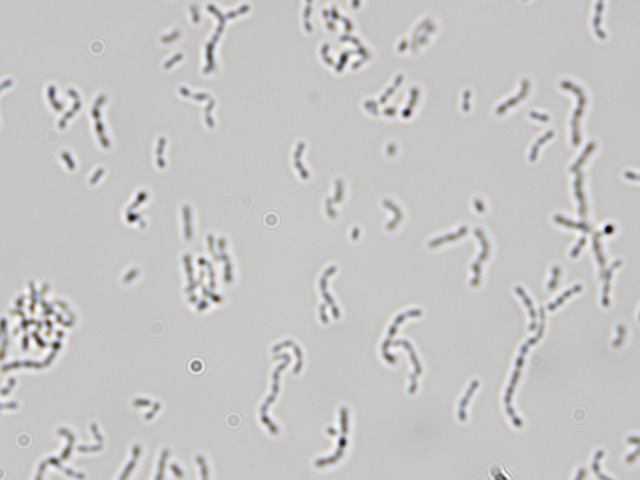 【#2】歯周病菌の培養方法をお見せします！！