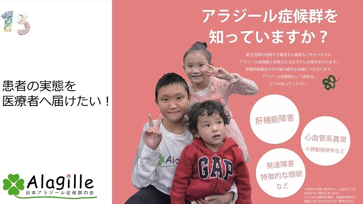 希少難病であるアラジール症候群の実態を医師へ届けたい!!