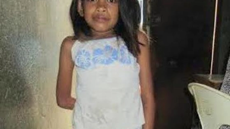 セブ島の墓場で暮らし、体に障害を持つ少女ハニーに学習の機会を