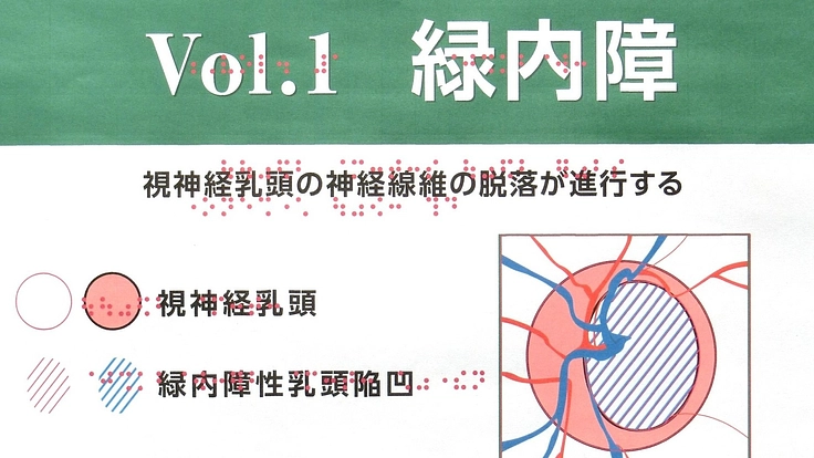 「視覚障害者の眼の病気を理解しよう」プロジェクト