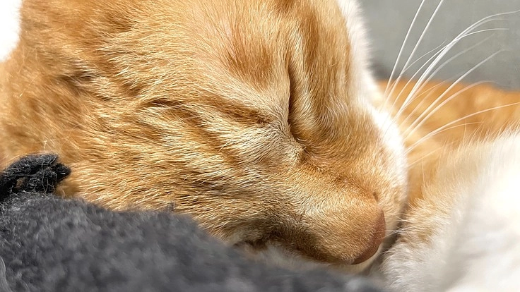 【尿道再建手術】おなかに穴が開いています。ご支援お願い致します。