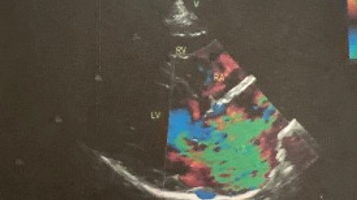 ビッケを支えてくれる皆様へ　ビッケの病気「僧帽弁閉鎖不全症」とは