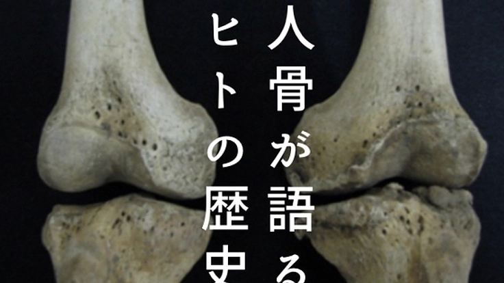 縄文人も虫歯に苦しんだ？骨と病で紐解く、3万年の"日本社会"史