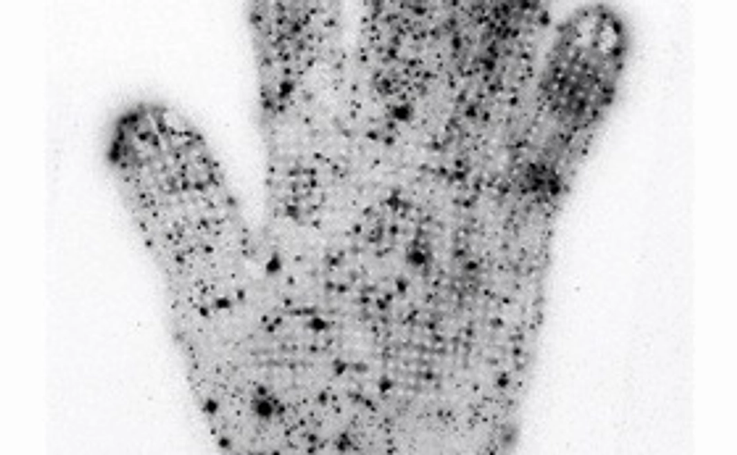 放射線像ポストカード