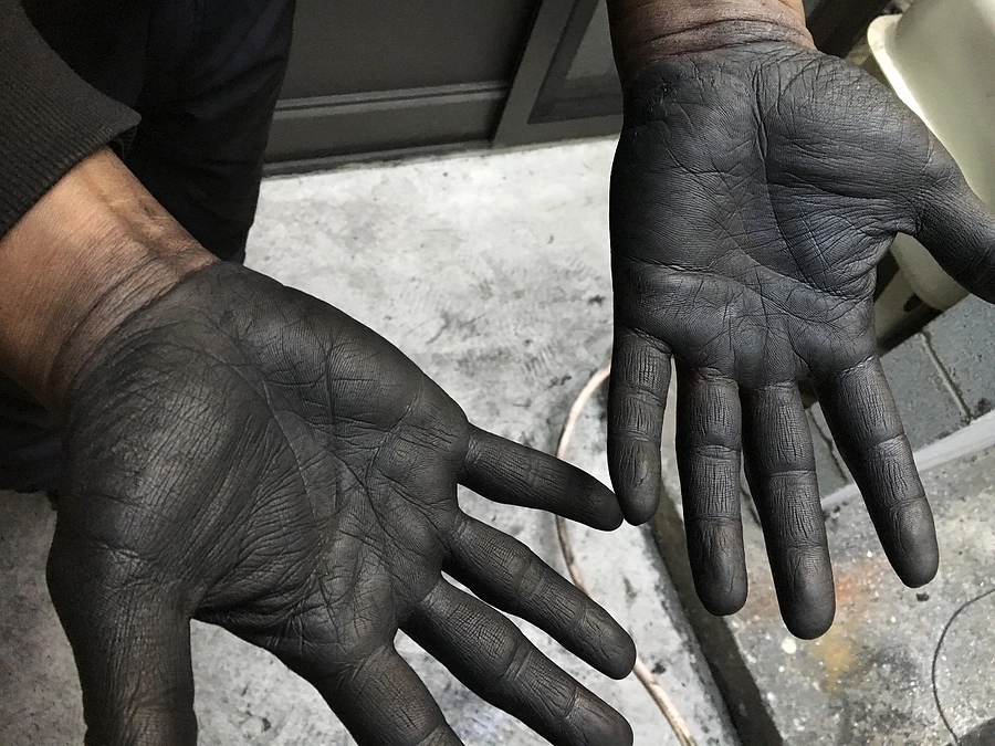 クラウドファンディングの進捗について