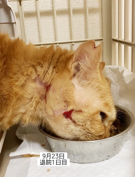 9月22日退院しました！！