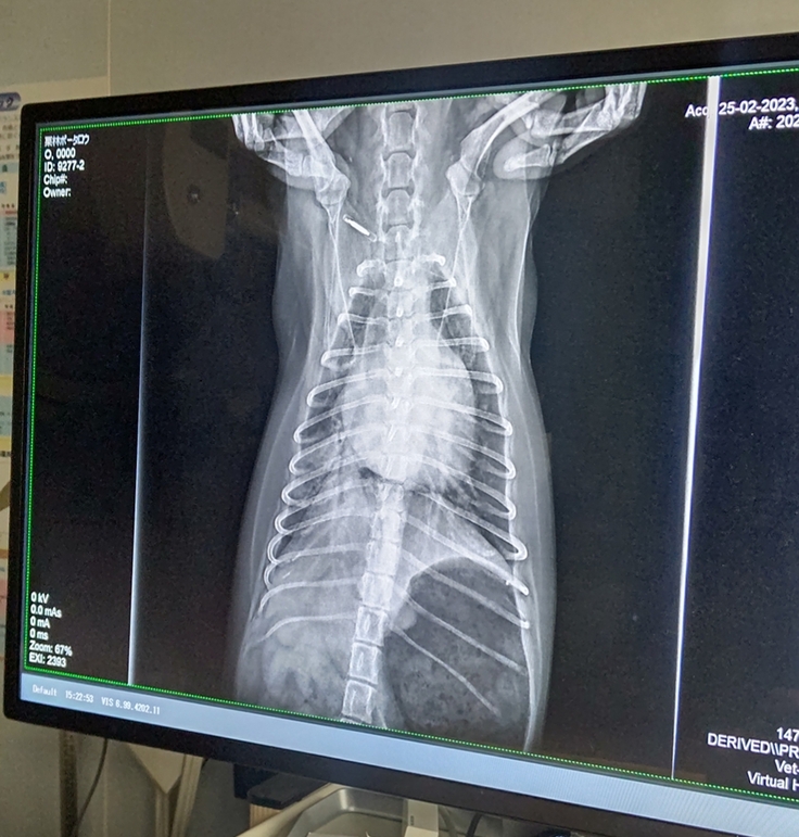 2月25日の肺水腫レントゲン