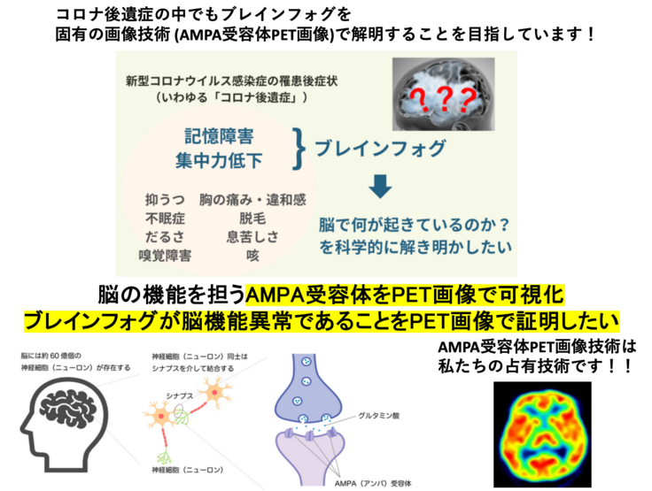 AMPA受容体PET画像でブレインフォグの脳機能異常を証明したい
