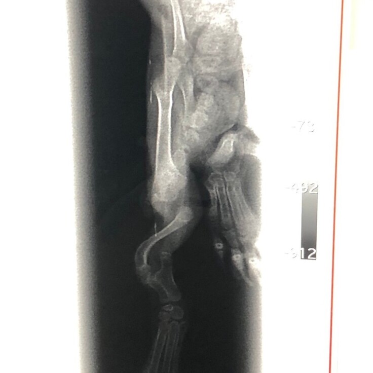 脚のレントゲン２