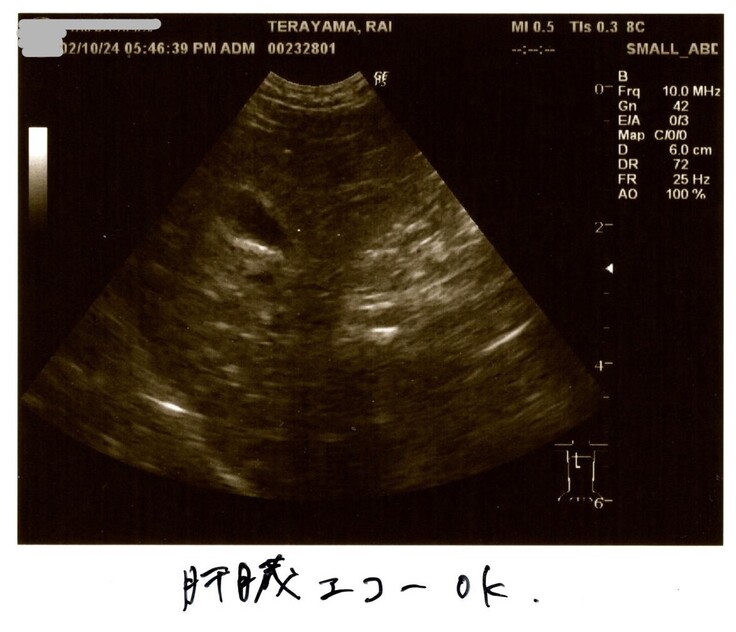 0210エコー2.jpg