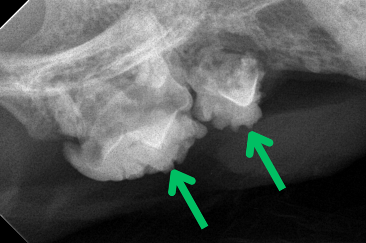 【レントゲン写真】