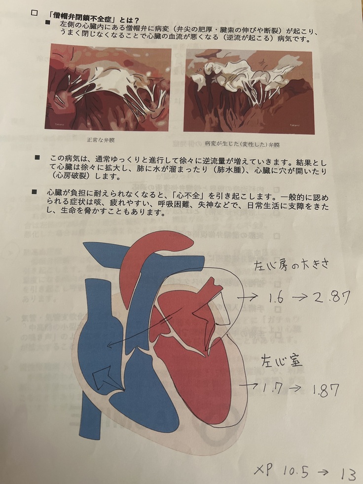 僧帽弁閉鎖不全症とは?