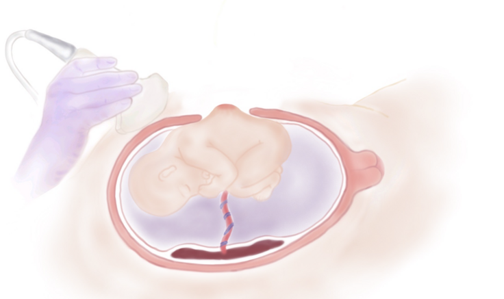 スクリーンショット 2025-04-23 18.39.16.png