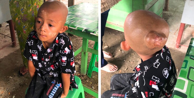 手術を待つ患者さん