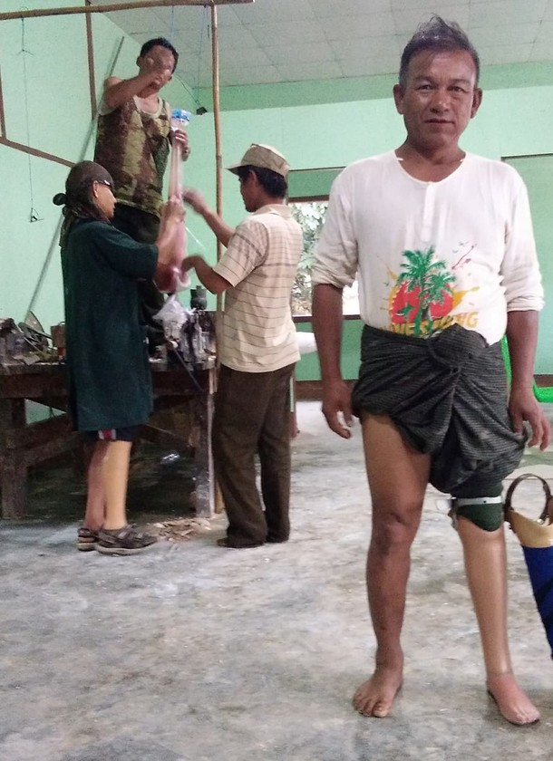 ミャンマー義足支援 現地での活動スタート 地雷廃絶日本キャンペーン Jcbl