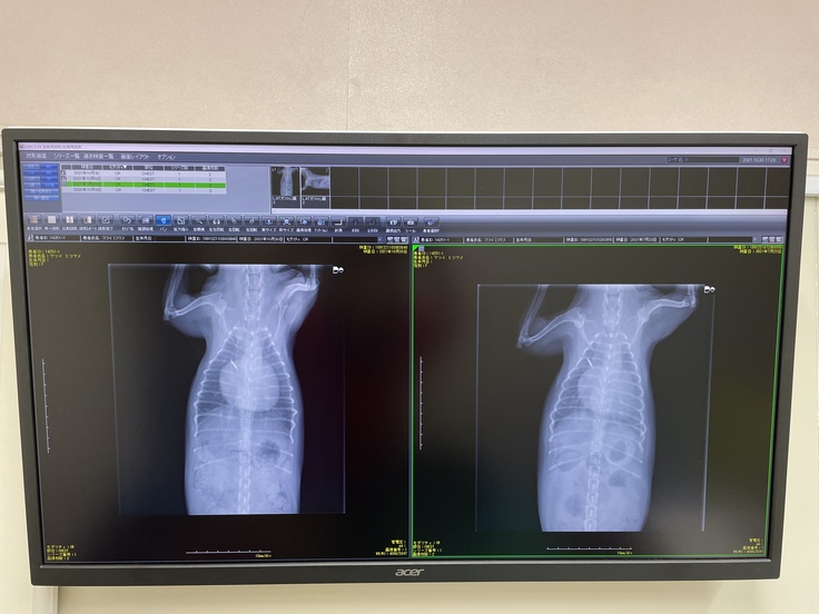 右が2021年7月の画像、肺に水が浸潤している