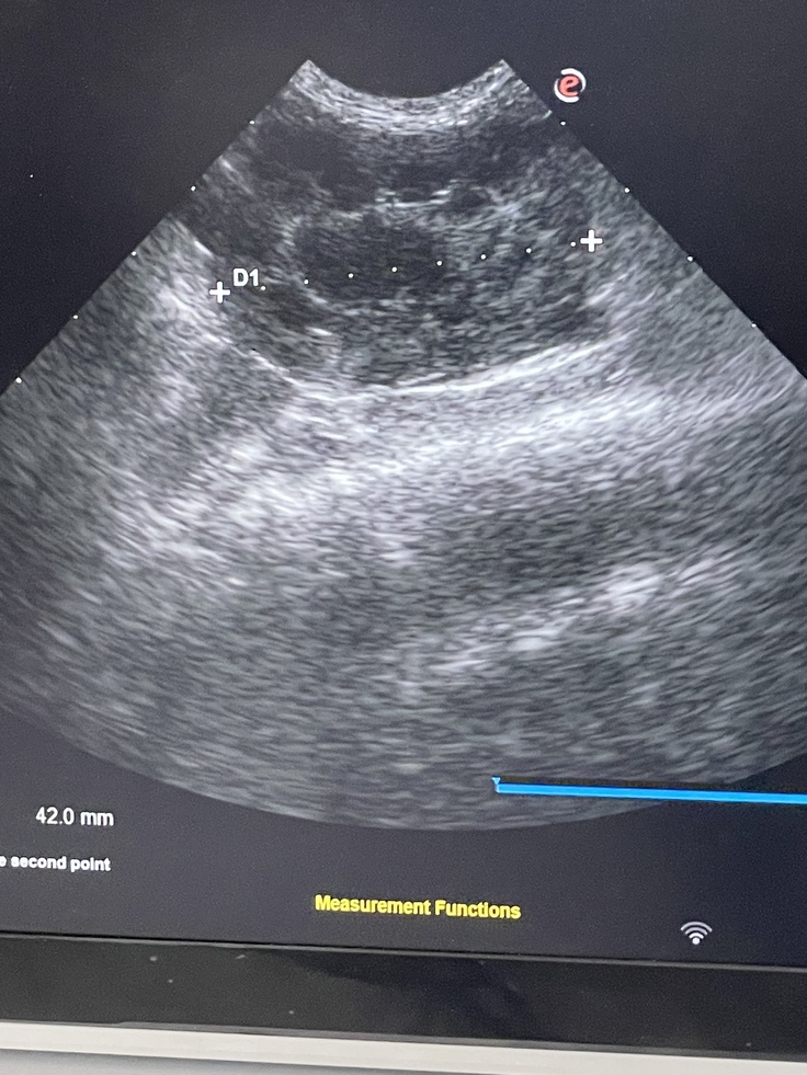 FIP決定ですねとこの画像から言われました