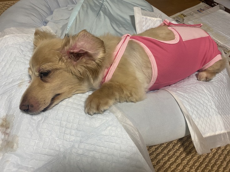 肝細胞腫瘍手術モコ