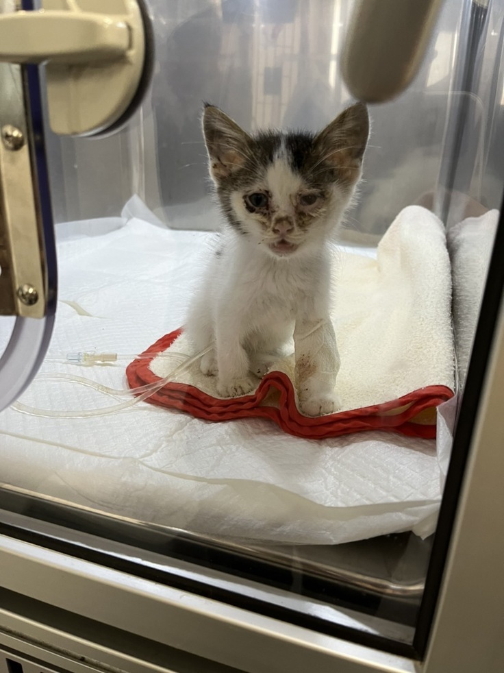 2日後に肺炎で入院