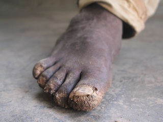 一生歩ける幸せを！ケニアの子どもにきれいな運動靴を届けたい！ のトップ画像