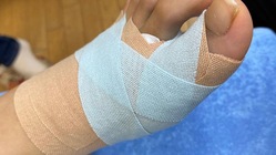 貼ったまま入浴できるテーピングの開発に成功 のトップ画像