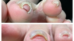 巻き爪などでお悩みの方に寄り添います のトップ画像