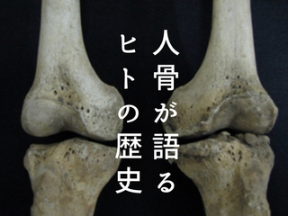 縄文人も虫歯に苦しんだ？骨と病で紐解く、3万年の"日本社会"史